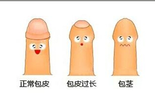 怎样认识包皮过长